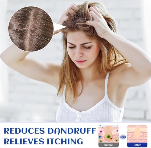 HIQILI Rosemary Oil for Hair Care, Diffuser & DIY